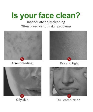 Anguishil Green Tea Mask Stick - Deep Cleanse & Oil Control for All Skin Types (1 PCS) - Buy Online on GoSupps.com