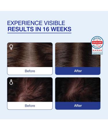 CosmeRNA Natural-Structure RNA-based Anti-Hair Loss Tonic for Thicker Fuller Healthier Hair for Biweekly Use Maximum 3-6 Months Supply for Men and Women 6ml (0.2 fl oz) (6ml with Shampoo Brush) - Buy Online on GoSupps.com