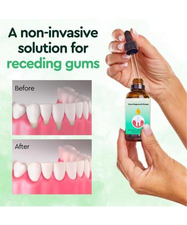 ZHONNA Pack of 2 Dentizen Gum Regrowth Drops - Rejuvenate Your Gums with Ease - Buy Online on GoSupps.com