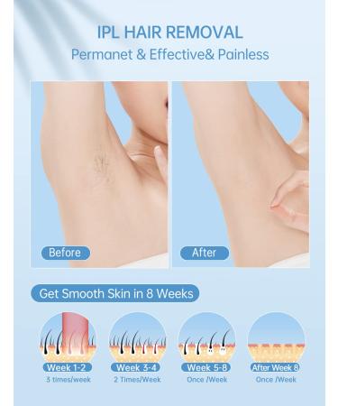 Laser Hair Removal with Cooling System - At-Home IPL Device for Permanent Hair Removal - 999,900 Flashes - Face, Legs, Arms, Bikini Line - White - Buy Online on GoSupps.com