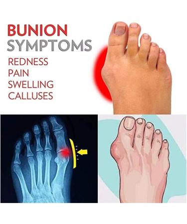 QYY Big Toe Foot Correction Sandal - Orthopedic Bunion Corrector for Men - Black Leather Casual Sandal - Size 10 - Buy Online on GoSupps.com