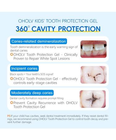 OHOLV Child-Safe Kids Toothpaste Fluoride Formula for Ages 0-6 Fights Cavities Removes Plaque Brightens Teeth Naturally SLS-Free 50g(1 Pack) - Buy Online on GoSupps.com