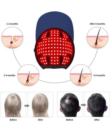 Chapeau De Th rapie par La Lumi re Rouge Casque De Croissance des Cheveux 660 Nm/850 Nm/940 Nm avec 160 Perles De Lampe LED 6 R glages De Temps Et 5 R glages De Luminosit Repousse des Cheveux - Buy Online on GoSupps.com