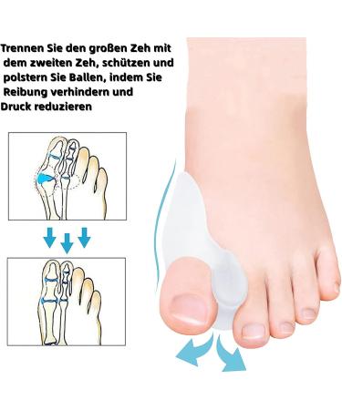 4-Piece Toe Spreader for Hallux Valgus - Silicone Ball Protection & Toe Separator Bandage - Pain Relief for Bunions - Buy Online on GoSupps.com