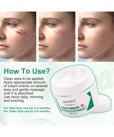 Scar Removal Cream for Old Scars, Stretch Marks & Burns - Natural Skin Repair for Acne Scars & Spots - Buy Online on GoSupps.com