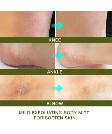 Lupure Deep Exfoliating Mitts - Exfoliating Glove for Soft Skin, Dead Skin Removal, Spray Tan & Keratosis Pilaris - Buy Online on GoSupps.com