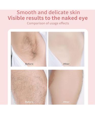 Duskofficial Razor The Glide Pro 3.0 Razor 2 in 1 Waterproof Electric Razor for Women Livora Electric Shaver for Women Wet Dry Use for Face Chin Body Arm Leg Armpit Bikini Trimmer(Blue) - Buy Online on GoSupps.com