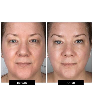 CurrentBody Skin Face Neck & D collet Set - Luxury Skincare Bundle for Radiant Skin | International Shipping Available - Buy Online on GoSupps.com