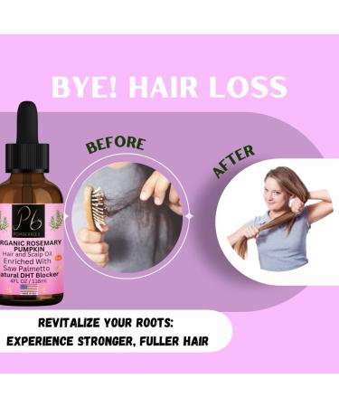 Organic Hair Growth Oil 4 fl oz - Rosemary & Saw Palmetto | Natural DHT Blocker Reduces Hair Loss Strengthens Roots | Unscented All Hair Types Unisex - Buy Online on GoSupps.com