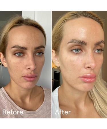 Anti-Blackhead Deep Pore Face Wash | Salicylic Acid Cleanser for Oily Skin | Acne Treatment & Oil Control | 150ml - Buy Online on GoSupps.com