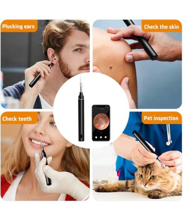Wireless HD Ear Cleaner - 1080p Endoscope Otoscope with 6 LED Lights for Adults & Kids - Effective Ear Wax Removal - Buy Online on GoSupps.com