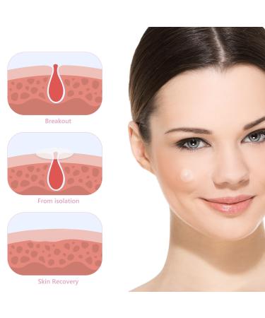 Dohia Pimple Patches - Hydrocolloid Acne Absorbing Cover for Face & Body | Invisible Tea Tree & Calendula Oil | 80 Patches - Buy Online on GoSupps.com