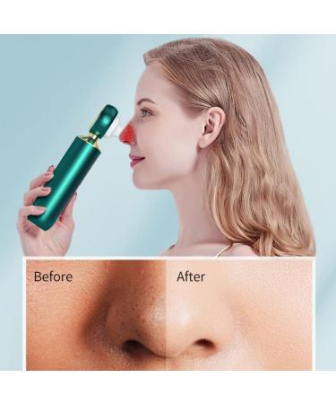 OuLi Store- Visual Electric Blackhead Remover Vacuum Deep cleaning 50 times magnification 3 Suction Heads USB plug (White+ Wrinkle remover instrument) - Buy Online on GoSupps.com