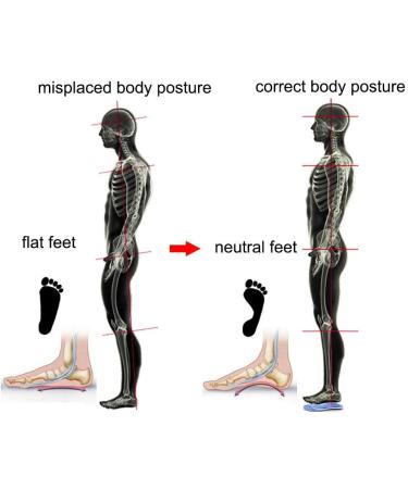 PCSSole Orthopedic Insoles for Work Sports & Comfort | Shoe Inserts for Flat Feet Plantar Fasciitis & Heel Pain - EU44-45 (29cm) - Unisex Blue - Buy Online on GoSupps.com