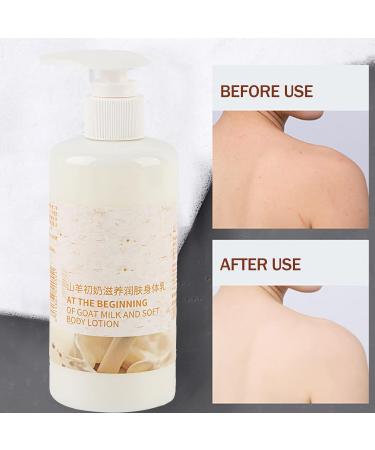 Natural Goat Milk Body Lotion | Strong Hydration & Skin Lightening | 250ml Moisturizing Cream for Dry Skin & Chicken Skin Care - Buy Online on GoSupps.com