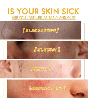  BAInuai Lot de 2 masques Peel Off Honey Face Mask Honey Tearing Mask Peel Mask Peel Mask Dead Skin Oil Control Blackhead Remover Skin Clean Pores Shrink for Men and Women - Buy Online on GoSupps.com