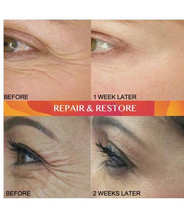 Buy (2-PACK) Vitamin C Serum with Hyaluronic Acid - Natural Anti Aging Facial & Eye Serum for Age Spots & Sun Damage - Fast International Shipping - New Age - Buy Online on GoSupps.com