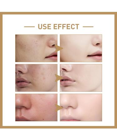 Natural Rice Face Toner Smoothing Toner for Face Facial Toner for Dry Essential Toner Deep Hydration Rice Face Toner Natural Moisturizer Glow Essence Rice Toner for Face Rice Toner - Buy Online on GoSupps.com