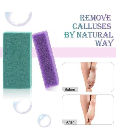 Useful and Nice4 Pcs Pumice Stone for Feet Hard Dead Skin Cracked Heel Callus Remover for Feet Skin Callus Remover & Scrubber - Buy Online on GoSupps.com