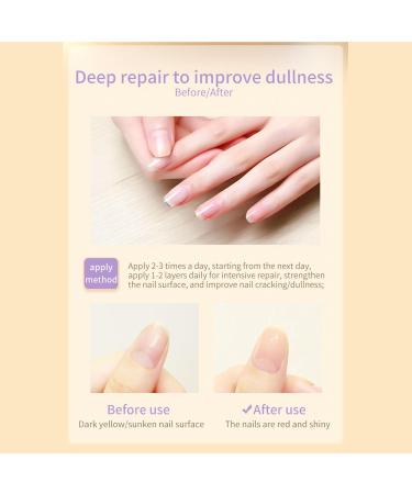 Cuticle Oil for Nails 7.5ml Nail Oil Nail Cuticle Oil with Jojoba Oil & Lavender Extract Nails Oil for Damage Nails Moisturizes Strengthen Nail Growth & Nail Repair Prevents Hangnails Cracked - Buy Online on GoSupps.com