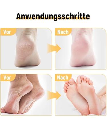 Cr me Pieds R paratrice Hydratante Cr me l'Ur e 60% Cr me pour les Pieds Secs et Fissur s creme crevasse pour Les Pieds a L'ur e pour Pieds Tr s S cs Ab m s (1) - Buy Online on GoSupps.com