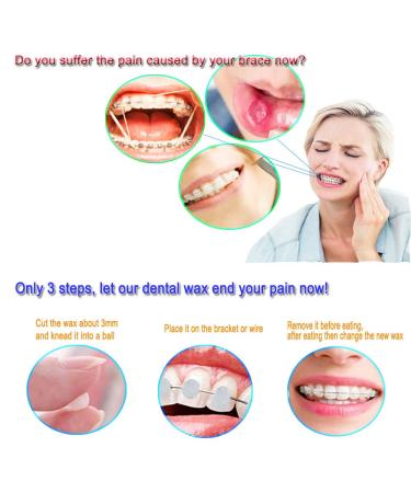 EvaGO Orthodontic Wax for Braces - 10 Pack, 10 Color & 10 Scents - Buy Online on GoSupps.com