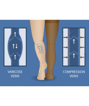 Premium CURANTIS Graduated Medical Compression Mid Thigh Stockings for Men and Women - Class 2 (23-32 mmHG) Socks Pair for varicose veins Maternity Nurses Travel Flight Sports - (Medium) Beige - Buy Online on GoSupps.com