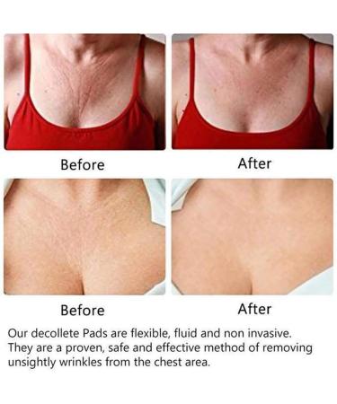 Premium Silicone Anti Wrinkle Chest Pad Decollete Pad - Eliminate Chest Wrinkles, Treat Scars & Stretch Marks - Buy Online on GoSupps.com