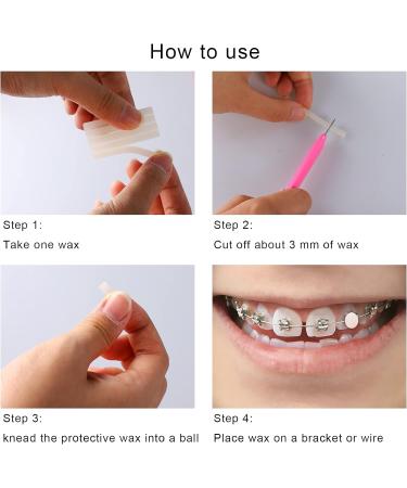 MorTime 12 PACK Dental Wax with Colorful Storage Cases - 60 Orthodontic Wax Strips for Braces & Aligners - Buy Online on GoSupps.com
