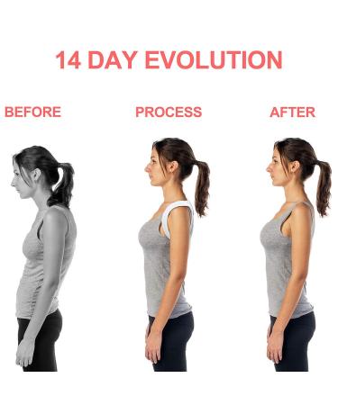 Posture Corrector for Men & Women - Adjustable Back Brace for Pain Relief & Support | Breathable Spinal Alignment & Humpback Orthosis - Buy Online on GoSupps.com