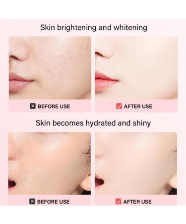 30mlLactic Acid 5% + Ha 2% Lactic Acid Pore Shrinking Essence Lactic Acid 5% Serum Lactic Acid Pore Minimizer Serum Facial Moisturizing Essence Collagen Serum with Hyaluronic Acid Face Serum for Women - Buy Online on GoSupps.com