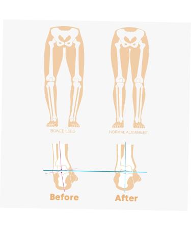 Orthopedic Insoles for Leg Correction | Bow Legs & Strephexopodia Support | Men's Boot & Flat Shoe Inserts - Buy Online on GoSupps.com