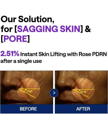 Mediheal Pdrn S rum lifting avec s rum cor en squalane pour le visage pour un teint naturellement clatant affine les pores raffermit la peau 40 ml violet - Buy Online on GoSupps.com