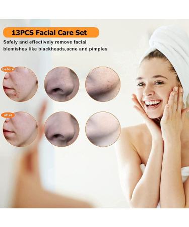 Blackhead Tweezers Kit Blackhead Remover Tools Kit Acne Extractor Tool Professional Stainless Pimple Acne Blemish Removal Tools with Portable Case (13-PCS) - Buy Online on GoSupps.com