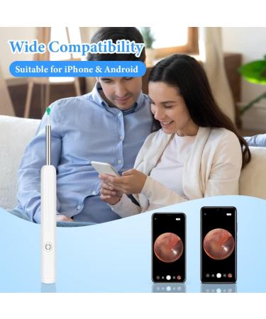 ACWOO Ear Wax Remover - 1296P HD Wireless Ear Wax Removal Kit with Camera - Visual Otoscope Ear Cleaner for Adults, Kids & Pets - Buy Online on GoSupps.com