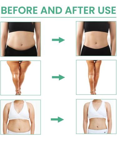 Welding Gel Belly Fat Burner Slim gel to firm your body moisturize the skin of the leg abdomen For leg belly and belly fat Miake - Buy Online on GoSupps.com