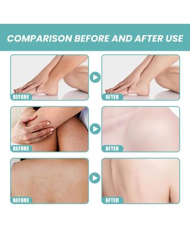 Skin So Soft Original Bath Oil - Moisturizing & Sensual Skin Care for Women | Ideal for Smooth Soft Skin - 1PC - Buy Online on GoSupps.com