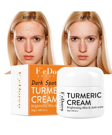 Premium Turmeric Facial Cream | Anti-Aging Moisturizer for All Skin Types | Radiant Glow with Vitamin E & Aloe Vera - Buy Online on GoSupps.com
