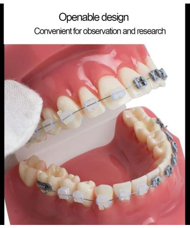 Dental Model Dentist Orthodontic Teeth Demonstration Model Orthodontic Dental Model with Ceramic Brackets and Metal Bracket for Learning Teaching Research - Buy Online on GoSupps.com