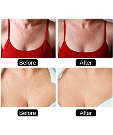 Silicone Chest Wrinkle Pads - Anti-Wrinkle Triangle Pads for Smooth, Tightened Skin - Buy Online on GoSupps.com