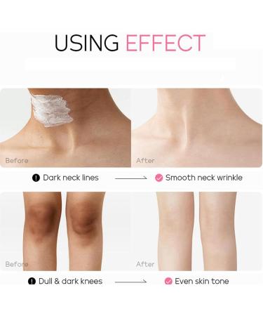 UnderarmCream For Dark Skin And Private Parts Armpit Lightening Cream Body Cream Dark Armpit Treatment Skin Lightening Cream Armpit Brightienng Body Brightening Cream For Dark Skin - Buy Online on GoSupps.com