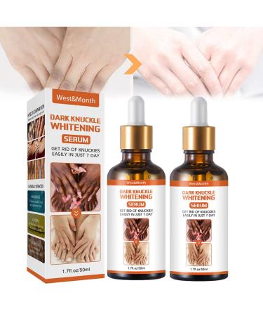 Whitening Serum Hand Knuckle Glow Serum Restoring Hand Treatment Moisturizing Exfoliates and Reduces Unbalanced Pigmentation for Removing Dark Knuckle Elbow Brighter Firmer Skin (2PCS) 1.7 Fl Oz (Pack of 2)