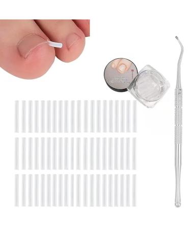 MDYBF Ingrown Toenail Removal Kit Ingrown Toenail Corrector 100pc Straightener Strips Foot Care Tool Corrector for Pain Relief Nail Growth Correction and Fungus Prevention