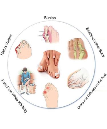 Pedimend Silicone Gel Toe Separator for Hallux Valgus Unisex Big Toe Protector & Straightening Holder | Effective Foot Care Solution - Buy Online on GoSupps.com