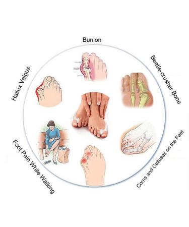 Pedimend Bunion Pain Relief Toe Separator (8PCS) - Bunion Corrector Pads for Hallux Valgus & Hammer Toe - Foot Care for Men and Women - Buy Online on GoSupps.com