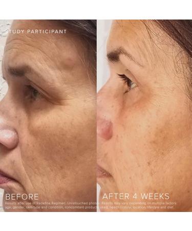 Buy Rodan + Fields Redefine Overnight Restorative Cream PM | Glow & Youthful Skin | International Shipping Available - Buy Online on GoSupps.com