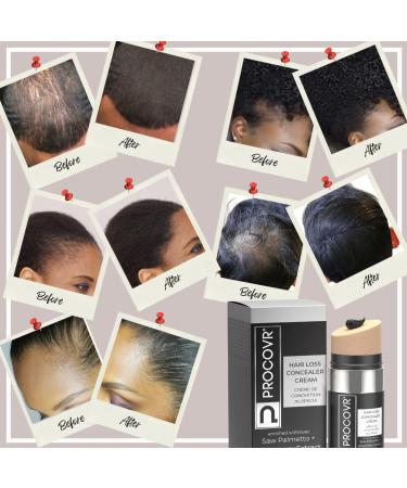 PROCOVR Hair Loss Concealer Cream with DHT Blockers - Saw Palmetto & Rosemary Extract | Hairline Enhancer & Root Touch Up | Natural Alternative to Hair Fibers & Powder - Buy Online on GoSupps.com