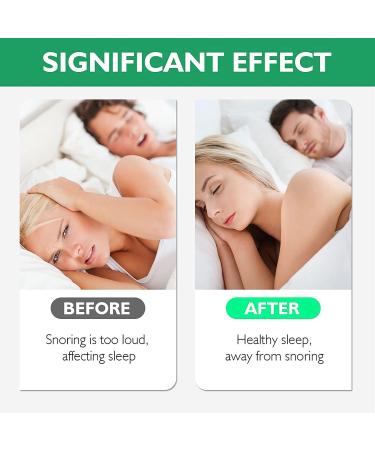 Snore Stopper Kit: 12 Pcs Anti-Snoring Nose Clips and Vents for Men and Women - Snoring Solution that Works - Buy Online on GoSupps.com