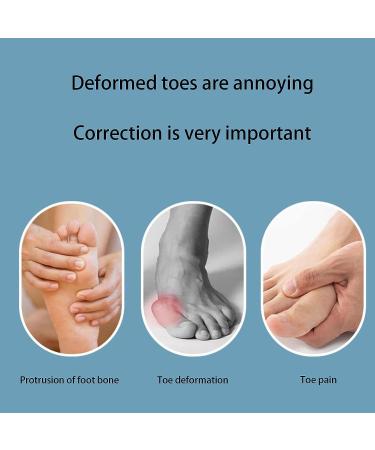 Samoka 6 PCS Gel Toe Separators for Bunion Correction and Toe Alignment - 3 Pairs (Blue/Pink/White) - Buy Online on GoSupps.com