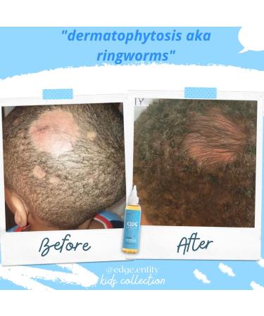 Edge Entity Grow Like Crazy Extreme Hair Growth Oil for Kids - 4oz | For Type 4 Hair and All Hair Types - Buy Online on GoSupps.com